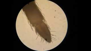 Mosquito under a microscope