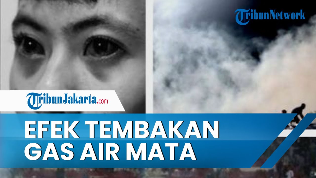 Fakta Mengejutkan Tragedi Kanjuruhan, Wajah Korban Meninggal Membiru