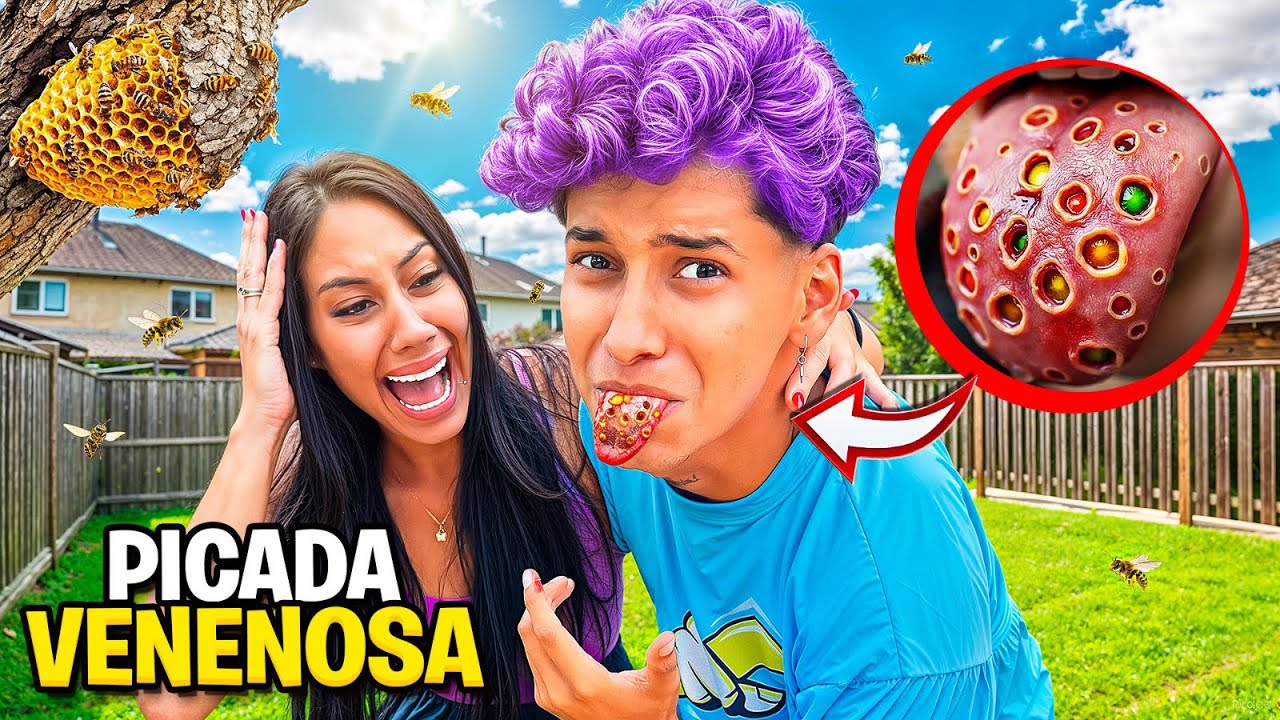 FUI PICADO POR ABELHAS VENENOSAS E O PIOR ACONTECEU!