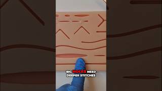 The deep dermal #suture #medicalsoctor #surgery #surgeon #medicalstudent