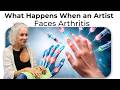 What Happens When an Artist Faces Arthritis — Her Stem Cell Story