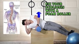 Fix Your Scoliosis with a Foam Roller (Scroth's Method) Resimi