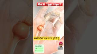 Trigger Finger Simplified with 3D Animation | Dr. Gunvinder Singh #medicalanimation #fingerhands
