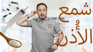 تنظيف وإزالة شمع الأذن بطريقة أمنه وإنت في البيت بدون تكلفة