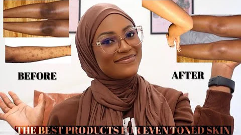 THE BEST BODY CARE PRODUCTS FOR SMOOTH & EVEN SKIN TONE ||CLEARING BODY HYPERPIGMENTATION AND ACNE