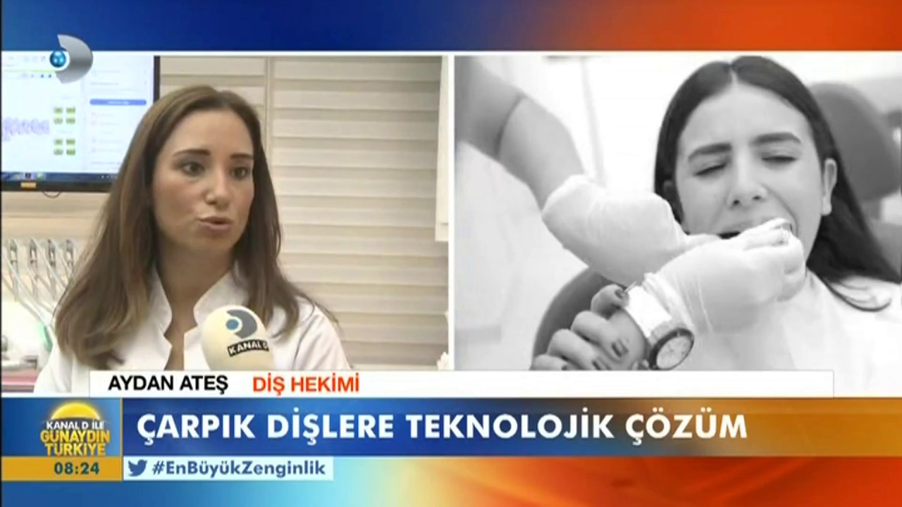 Çarpık dişlere Türk çözümü Çarpık dişlere Türk çözümü