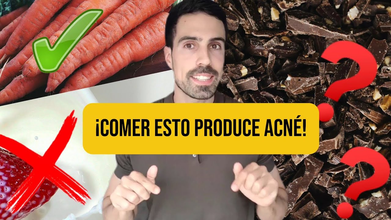 La MEJOR DIETA🥕 para el ACNÉ según especialista en DERMATOLOGÍA. ¡Que no te engañen con tu piel‼️