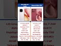Vivo IQOO Z11 Turbo VS Motorola Moto G86 5G Review & Comparison #smartphone #tech #mobilephone #vivo