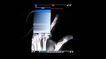 MobileCT: a mobile collaborative radiology app