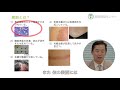 Scarless Healing 1 なぜ傷跡に見えるのか Scarless Healing 1 なぜ傷跡に見えるのか
