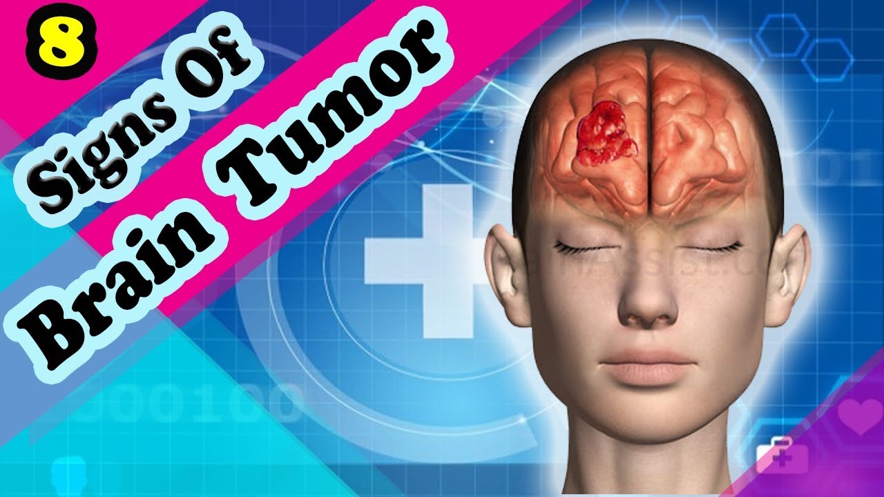 5 Warning Signs of Brain Tumour, No 3 is Shocking - YouTube
