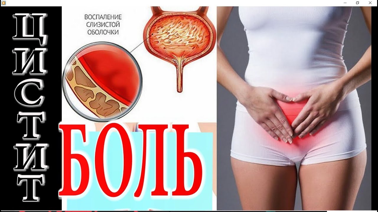 №1222 Хрон.Цистит, Летаргический сон, Кому, Стенокардию, Глухоту, и ...