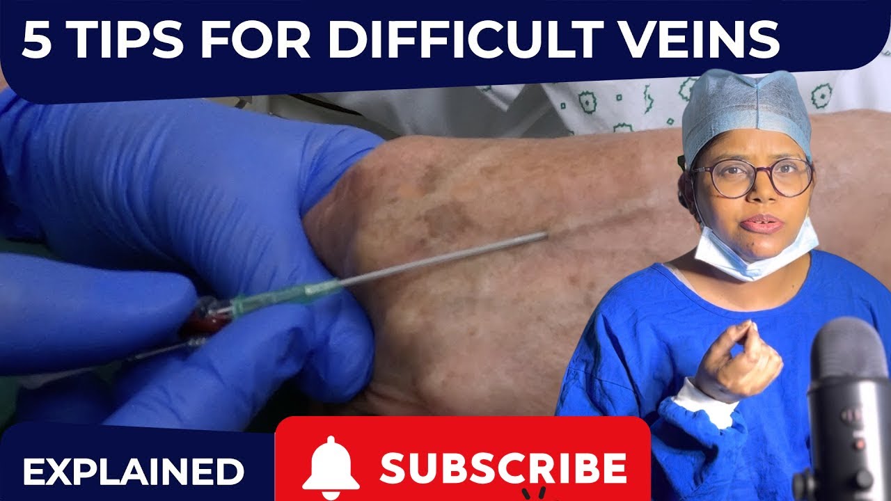 DIFFICULT IV:5TIPS TO KNOW | cannula insertion technique | cannula ...