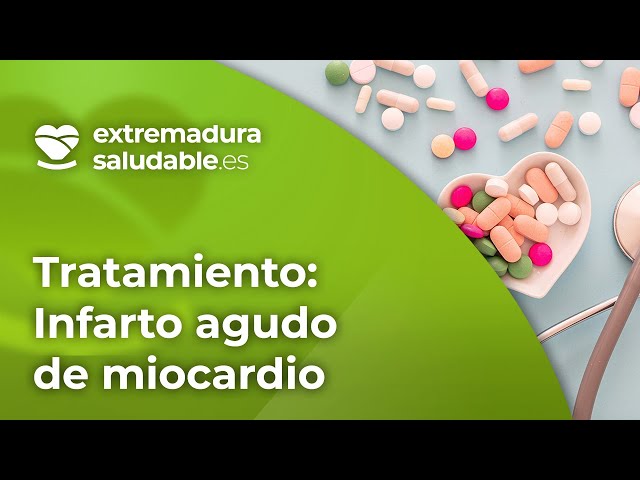 TRATAMIENTO del INFARTO DE MIOCARDIO