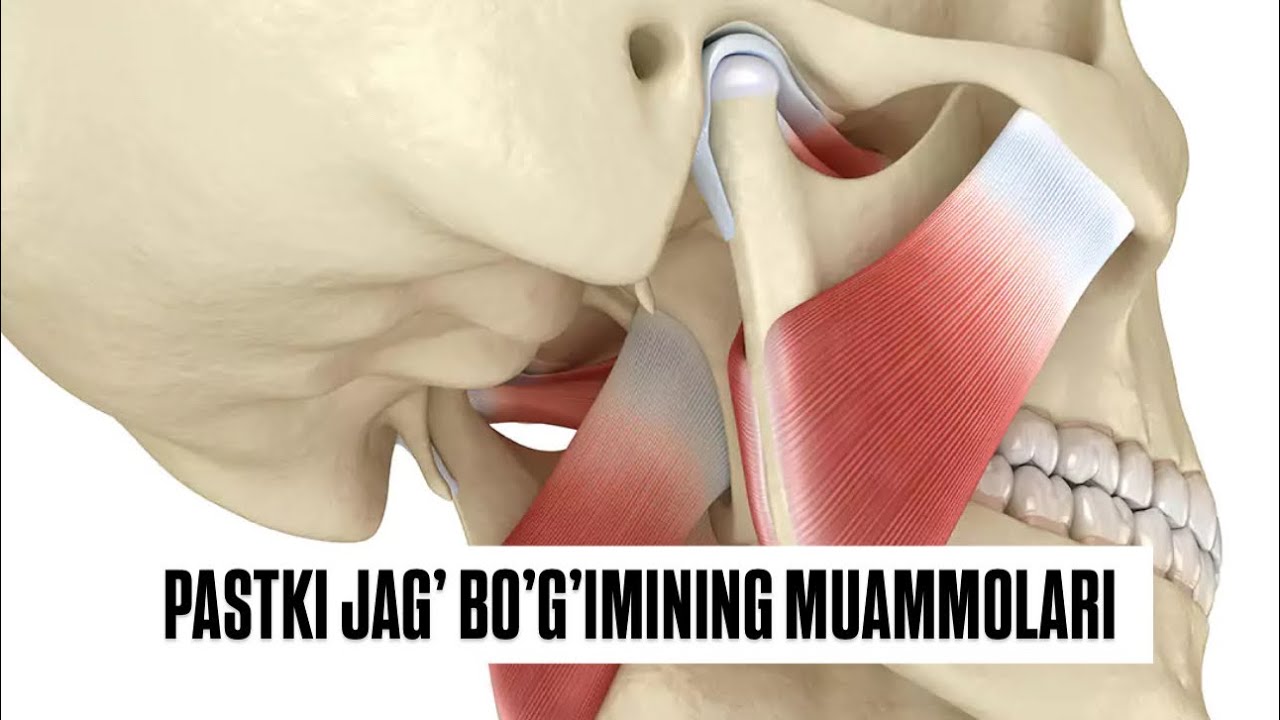 Pastki jag’ bo’g’imidagi muammolar ! ( jag’ qirsillashi, prikuslar, chakka pastki jag’ bo’g’imi ) 