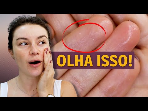 Vídeo: Óleo de jojoba em casa?