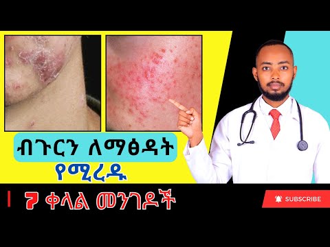 ቪዲዮ: ፈገግ ለማለት እንዴት ማስመሰል እንደሚቻል