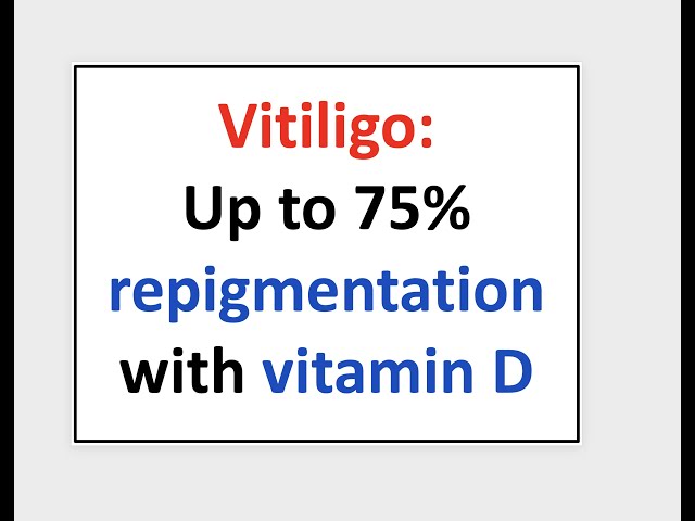 Vitiligo - 75% repigmentation with vitamin D supplementation - YouTube