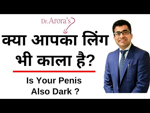 वीडियो: क्रॉस काला क्यों हो जाता है