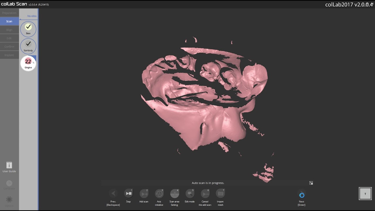 33a Scanning implant scanbody and base model separately YouTube