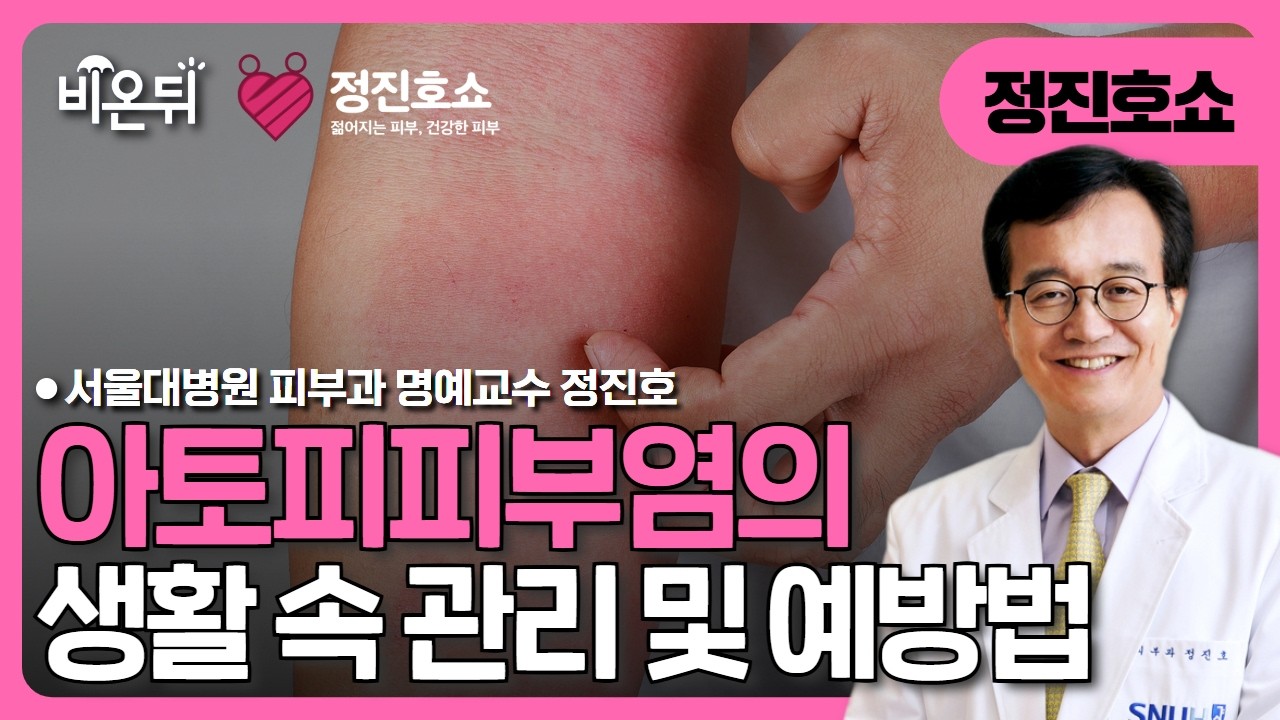 [정진호쇼, 젊어지는 피부 건강한 피부] 아토피피부염의 생활 속 관리 및 예방법/ 서울대병원 피부과 명예교수 정진호