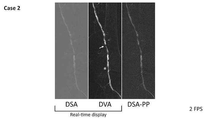 Kinepict Academy: Image Quality Comparison