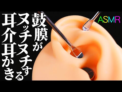 【ASMR】お耳の軟骨にヌッチヌッチとメリ込まれゾクゾクしちゃう耳介耳かきの音♡聴いたことが無いズヂズヂ音で耳の裏まで摩擦する特殊な耳介耳かき♪珍しく鼓膜ガリガリはございませんのでご安心をｗ【音好き】