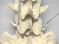 Pedicle Identification_spine surgery