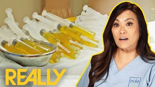 Dr Lee Removes Almost A Litre Of Mysterious Fluid | Dr Pimple Popper: Pop Up