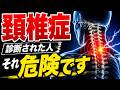【頚椎症】診断された人へ「知らないと悪化します」
