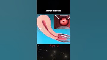 Thumbnail of 3D medical care opt. #vagina #uterus #pregnancy #short