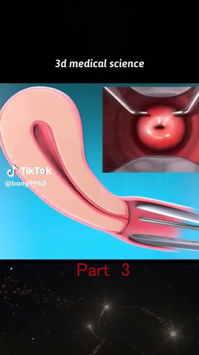 3D medical care opt. #vagina #uterus #pregnancy #short
