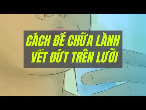 Video: Làm thế nào để ngăn chảy máu lưỡi: Chăm sóc sơ cứu và các cách tốt nhất để chữa lành