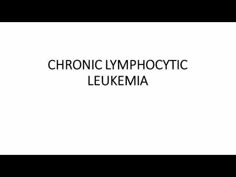 Video: Monoallelic Dan Penghapusan Biikal Daripada 13q14 Dalam Sekumpulan Pesakit CLL / SLL Disiasat Oleh CGH Haematological Cancer Dan SNP Array (8x60K)