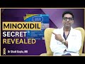 Minoxidil Results | Minoxidil Usage | Minoxidil Side effects by Dr Shail Gupta