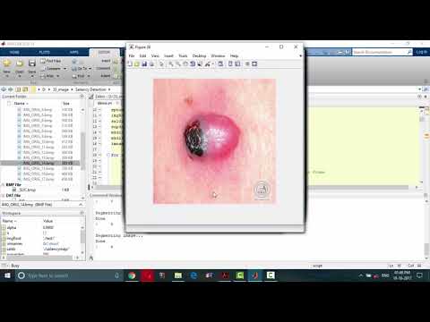 SALIENCY DETECTION USING matlab