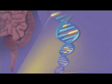 DNA Stool Test for Colon Cancer-Mayo Clinic