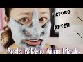 First Impressions ♥ Mediheal Mogongtox Soda Bubble Acne Sheet Mask