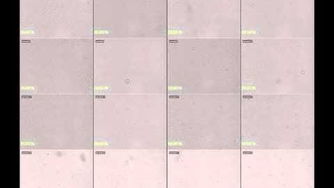 [JuLI Stage Application Video] Cell proliferation in multi-well simultaneously