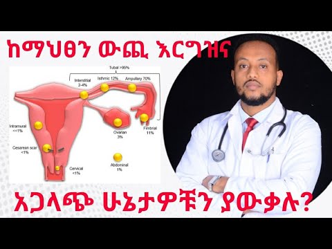 ቪዲዮ: ከ Ectopic እርግዝና እንዴት እንደሚድን (ከስዕሎች ጋር)