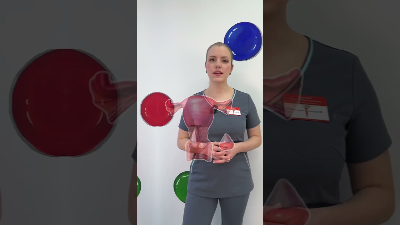 КОНИЗАЦИЯ ШЕЙКИ МАТКИ.Рассказывает врач-хирург клиники «Академия VIP» Борисова ДА ☎️ (831) 270-00-00