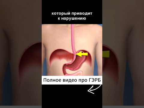 Главная причина ИЗЖОГИ, ОТРЫЖКИ, ГЭРБ, рефлюксов. Этого не расскажет ни один врач!