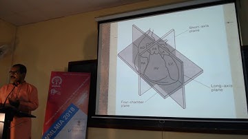 Echocardiography Video Analysis, Jayanta Mukhopadhyay, IIT Kharagpur, WMLMIA2018