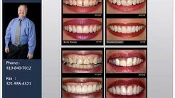 Cosmetic Dentistry by Westminster Maryland Dentist Dr. ... 