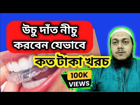 ভিডিও: একটি ছোট ডেন্ট ঠিক করতে কত খরচ হয়?