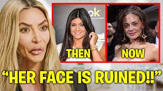 Kim Kardashian EXPOSES Kylie Jenner’s BOTCHED Plastic Surgery