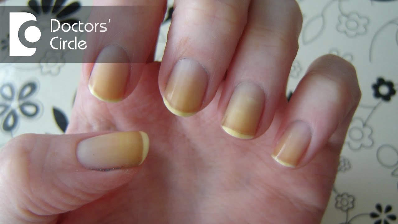 25 Cute Coloured French Tip Nail Ideas : Pastel Yellow Tip Nails