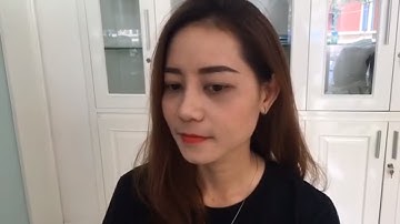 Nâng mũi cao sang - Chuẩn thời thượng chỉ sau 10 ngày