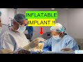 Inflatable penile implant live  ams700 lgx steps explained simply