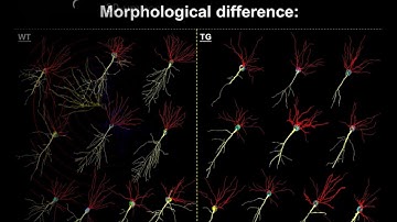 3D Neural Morphometrics